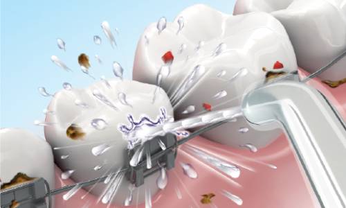 Orthodontic care